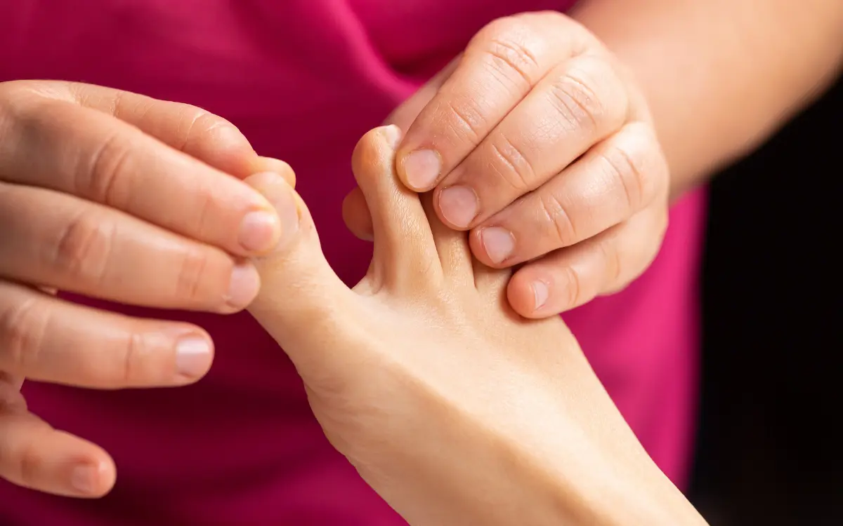 Fußpilz Symptome zwischen den Zehen mit Rötung Schuppung und Mazeration